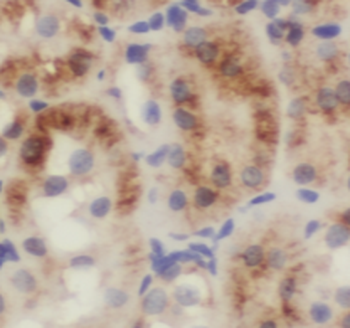 TRAPPC9 Antibody