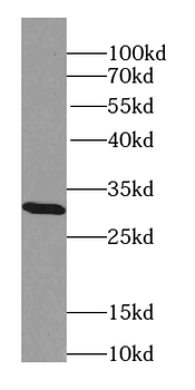 TRAV20 Rabbit Polyclonal Antibody