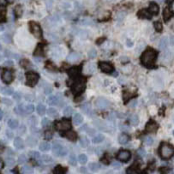 TRAV20 Rabbit Polyclonal Antibody