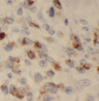 TFF1 Antibody