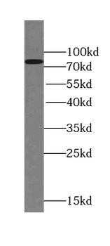 TSNAXIP1 Antibody