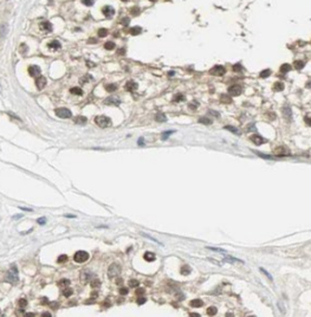 TSNAXIP1 Antibody
