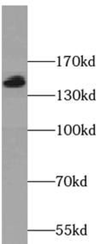 SKIC3 Rabbit Polyclonal Antibody