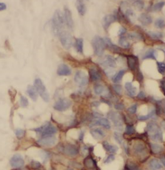 TTC39A Antibody