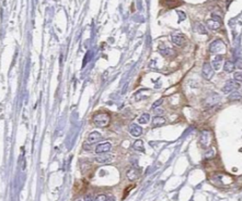 TWNK Antibody