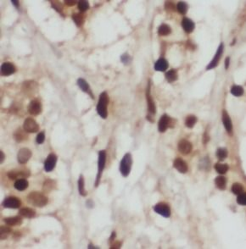 U2AF1 Rabbit Polyclonal Antibody