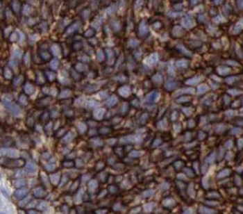 UBE2I Antibody