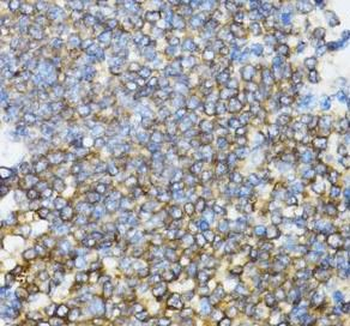 UBE2D1 Antibody