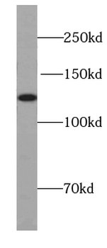 UBN1 Specific Rabbit Polyclonal Antibody