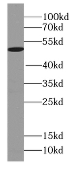 UBXN6 Antibody