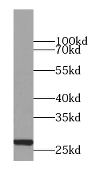 CMPK1 Antibody