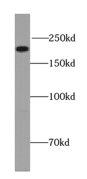UNC13A Rabbit Polyclonal Antibody