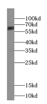 UNC5D Antibody
