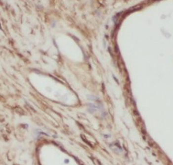 VRTN Antibody