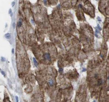 PIK3C3 Antibody