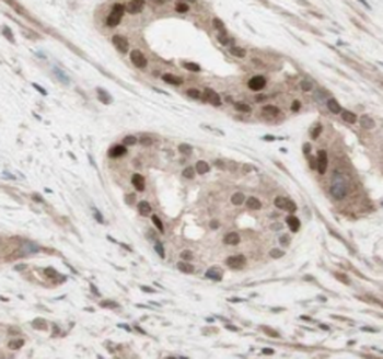 LAT2 Antibody