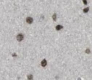 WDR81 Antibody