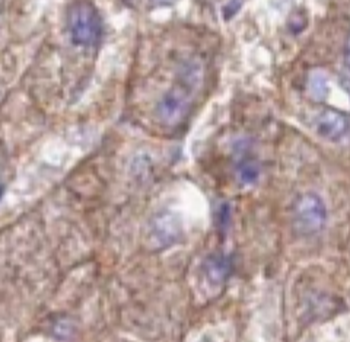 FRMD6 Antibody