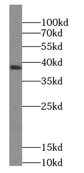 WNT5A-B Antibody