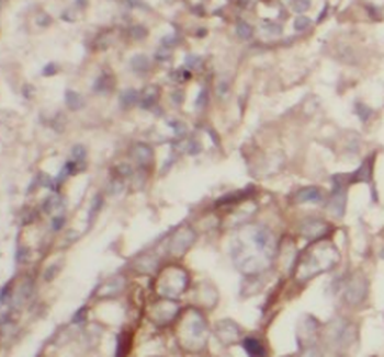 WNT5A-B Antibody