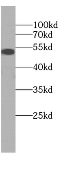 DAPK3 Antibody