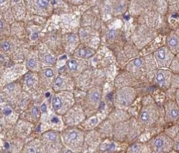 SLC39A4 Antibody