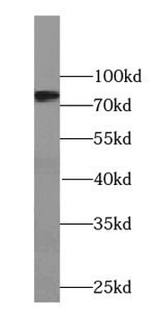SCNN1B Rabbit Polyclonal Antibody