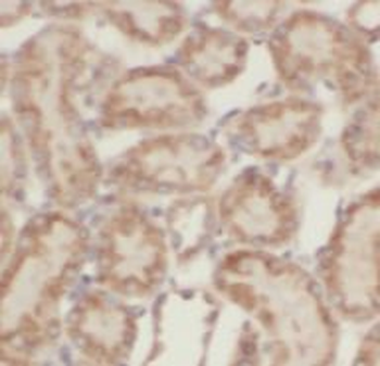 SCNN1B Rabbit Polyclonal Antibody