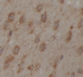 YWHAQ Antibody