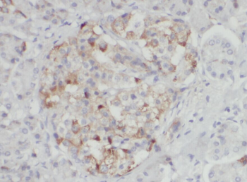 ALOX15B Antibody
