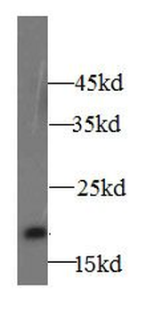 GGACT Antibody