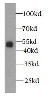 A4GALT Antibody