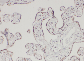 AAMP Antibody