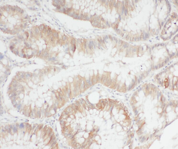 APEH antibody