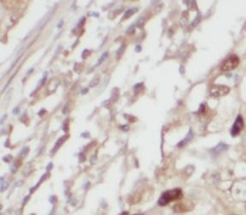 AARS2 Antibody
