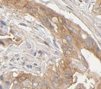 ABAT Antibody