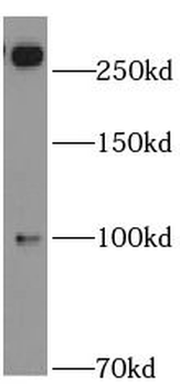ABCA2 Antibody