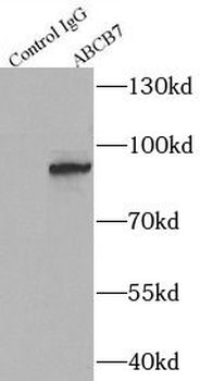 ABCB7 Antibody