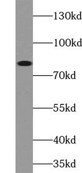 ABCB7 Antibody