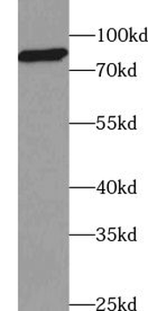 ABCB9 Antibody
