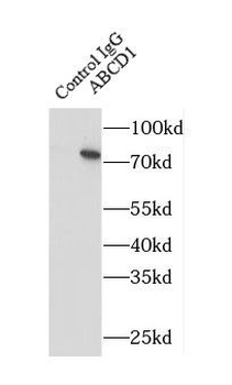 ABCD1 Antibody