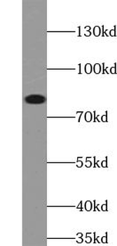 ABCD1 Rabbit Polyclonal Antibody