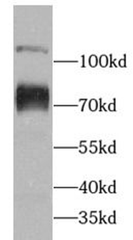ABCF2 Antibody