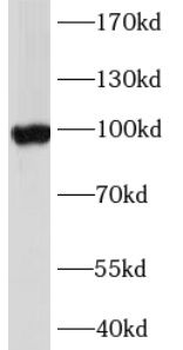 ABCG1 Antibody