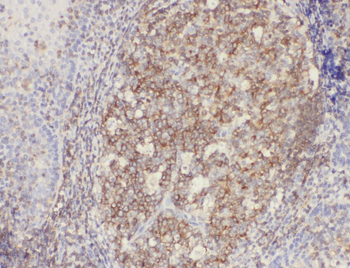 ABCG1 Antibody