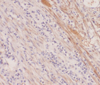 ABHD12B Antibody