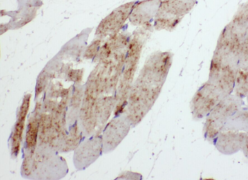 ABHD5 Antibody