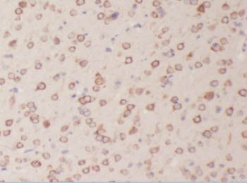 ABI2 Antibody