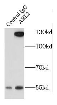ABL2 Antibody