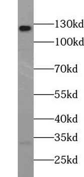 ABL2 Antibody